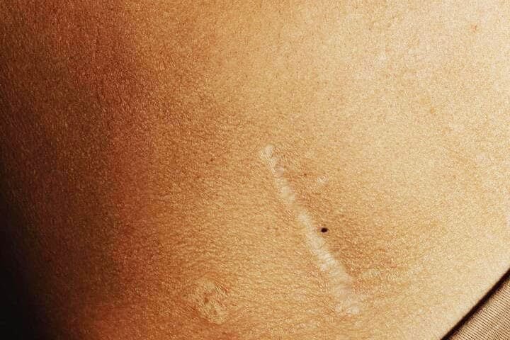 10 Maneiras como a Terapia Psicanalítica Ajuda na Cura de Feridas Emocionais